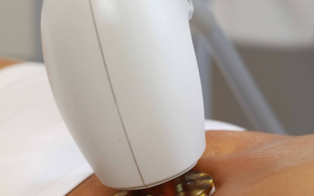 The New Era of Non‑Invasive Body Contouring on the Gold Coast