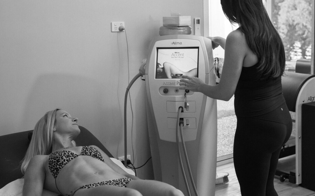 How to Choose the Right Non‑Invasive Body Sculpting Treatment for Your Goals on the Gold Coast